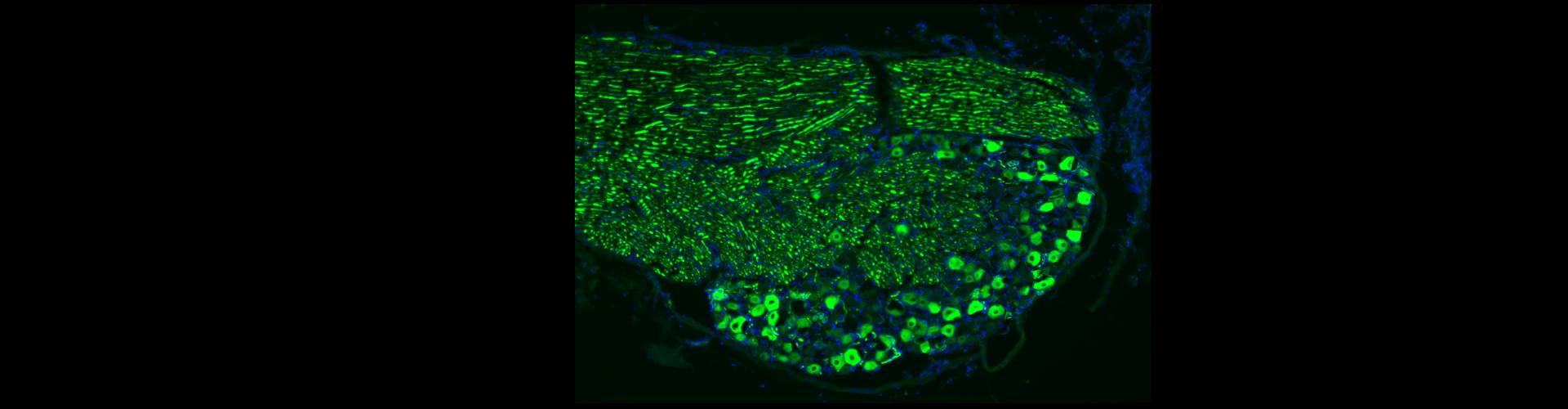 Optimizing functional outcomes in chronically injured rats