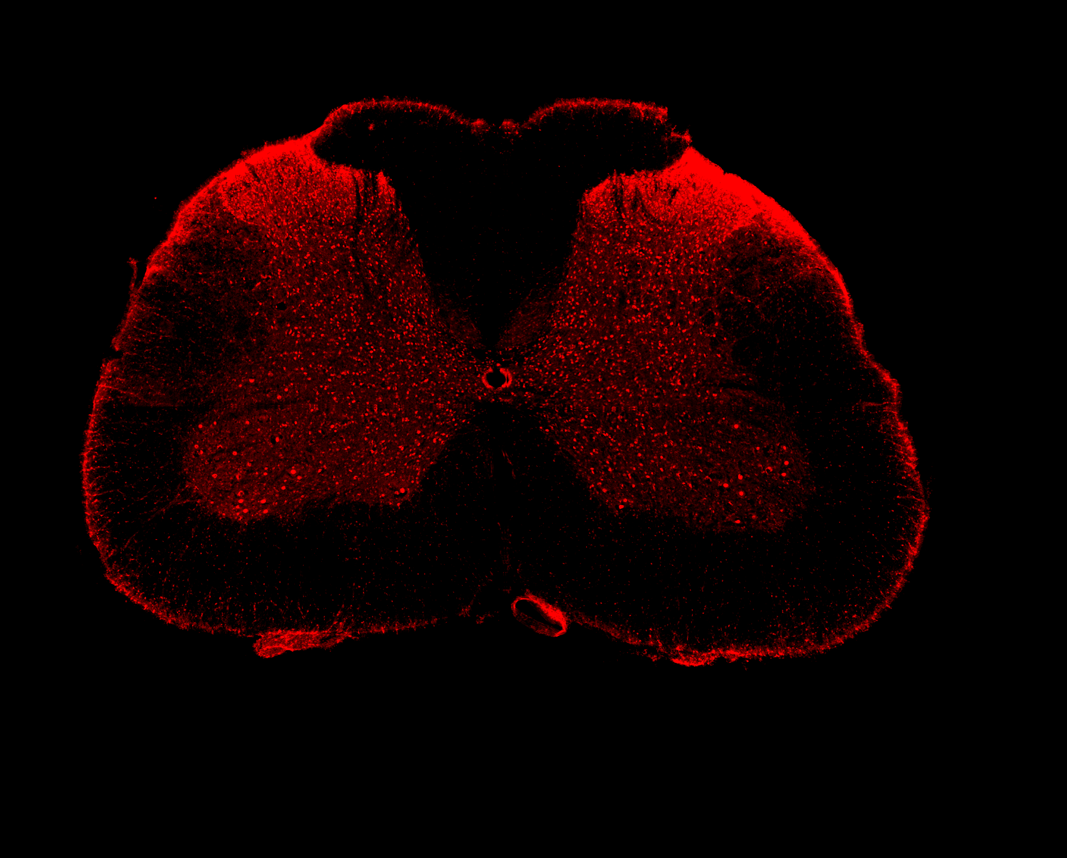 Improving bladder function after spinal cord injury